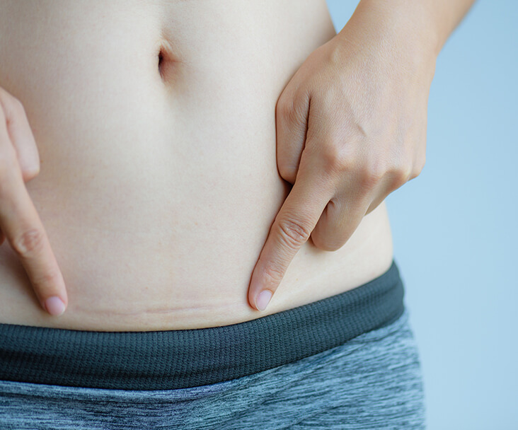 Cirujano bariatra apendicitis en df