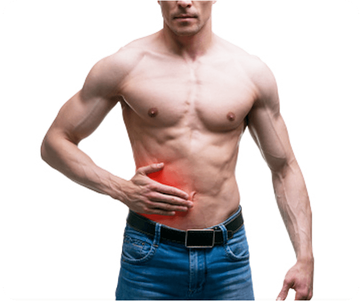 apendicitis